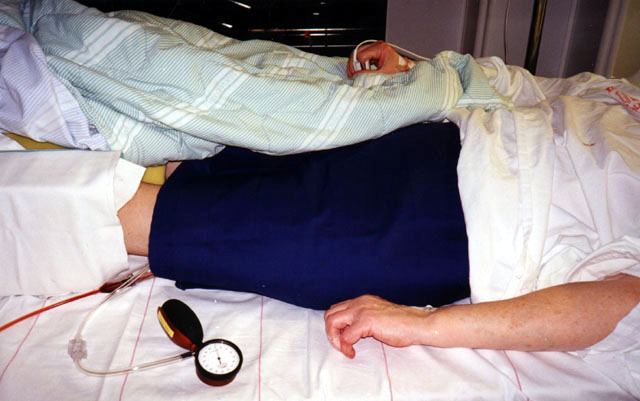Compression bandagde